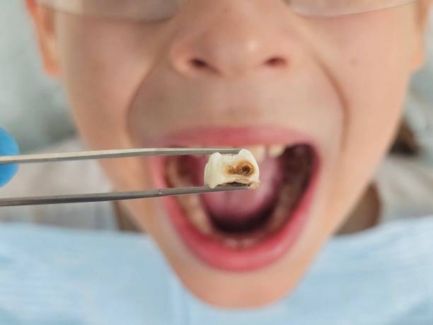 Best Walk-In Emergency Dentist in Hazel Park, MI